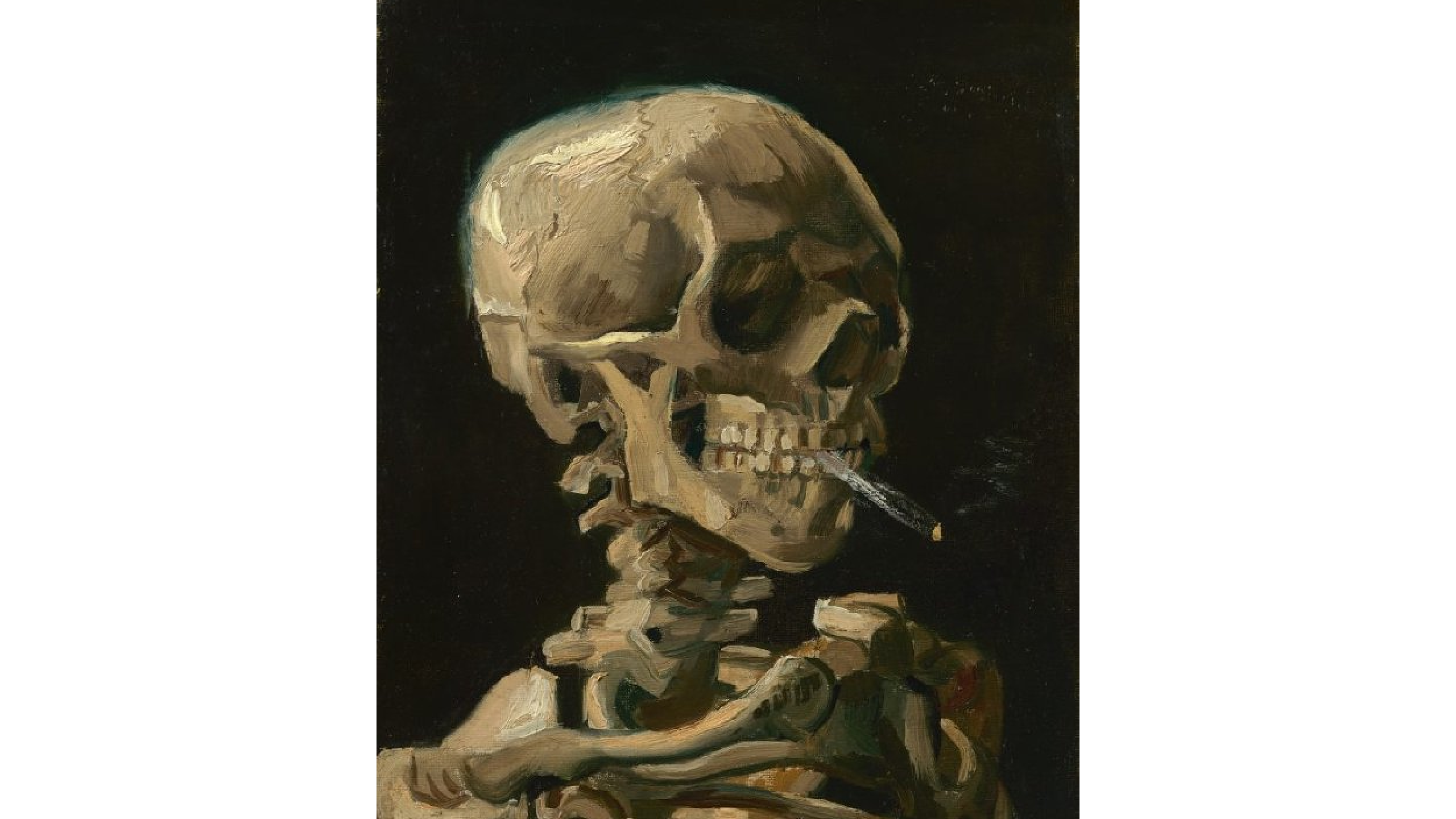 oil painting, shows the superior part of a skeleton; the skull, neck and shoulders, with a burning cigarrete on the mouth. background is black.